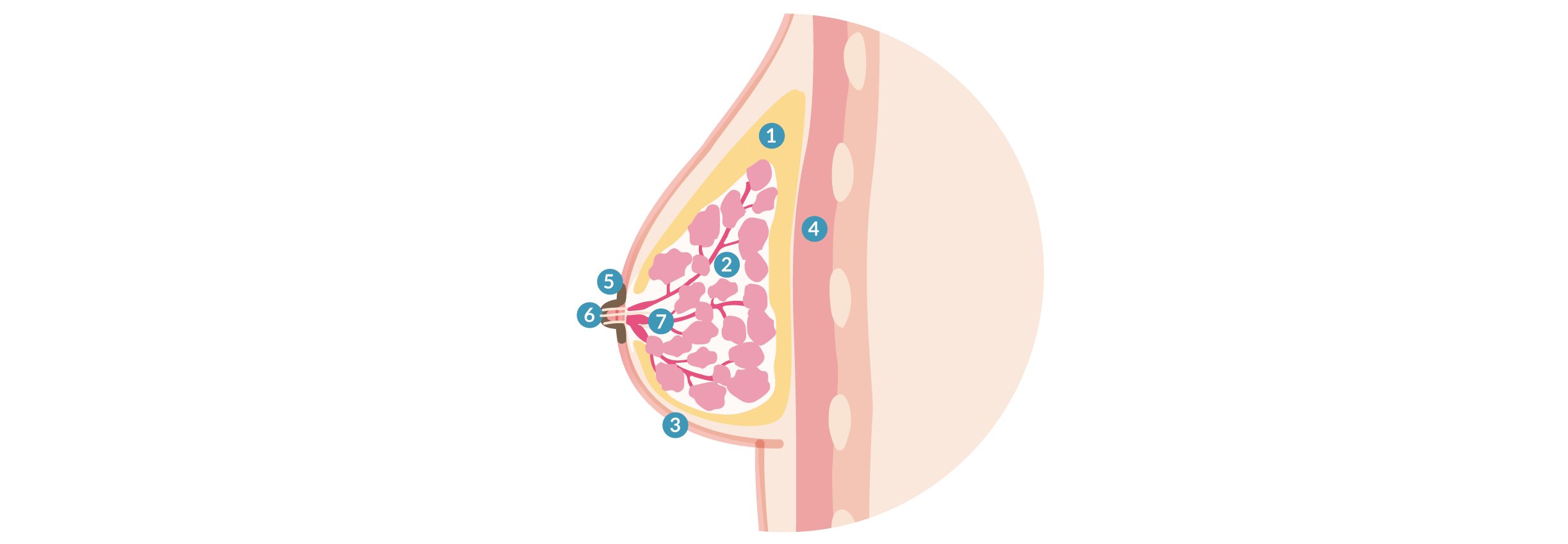 schema-implant-sein-profil